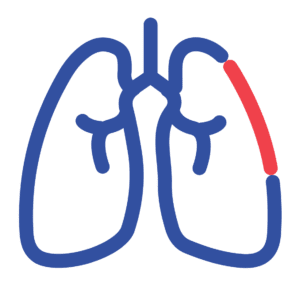 Pulmonale-Rehabilitation